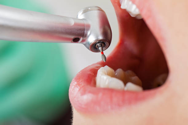 Best Dentist for Tooth Abscess  in Monmouth Beach, NJ